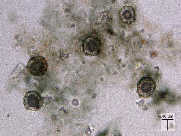 UnknownBiological_MR_BV_PP-600.jpg