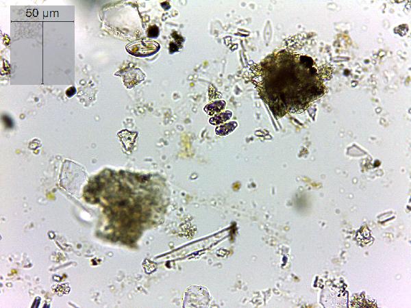 Scenedesmus_sp_HK0010.jpg-600.jpg