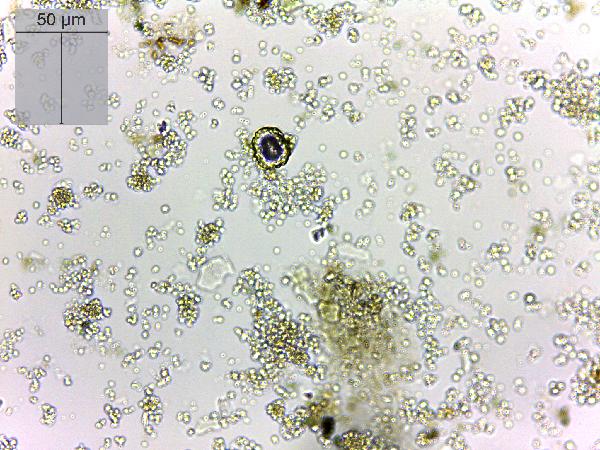cf_Cosmarium_emptyHK0006.jpg-600.jpg