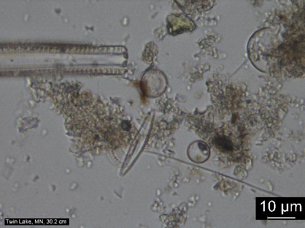 diatom1_TwinLk_MN_63xdryBF_ME-600.jpg
