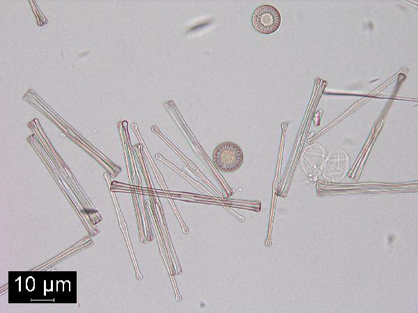 diatom8_KekLk_40xBFME-600.jpg