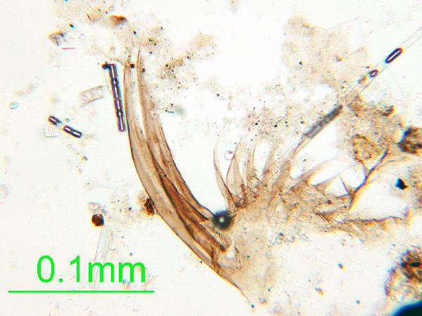 Daphnia_01_pp_AB-600.jpg