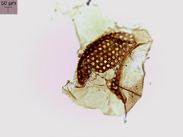 chiro-033-IRW.jpg-600.jpg