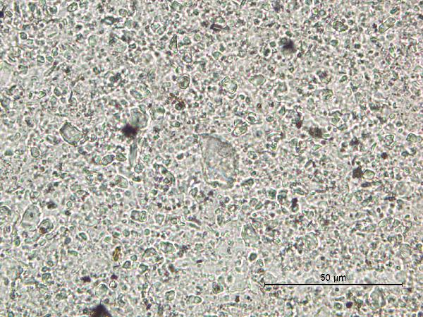 GNP-SWF10-3D-8L-1-W_33.8cm_glacvarv_depresslight_63x_pp-600.jpg