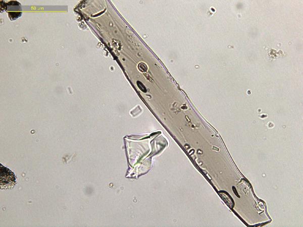 RDF_2A1K6_79_6_microtubule_400X_PP-600.jpg
