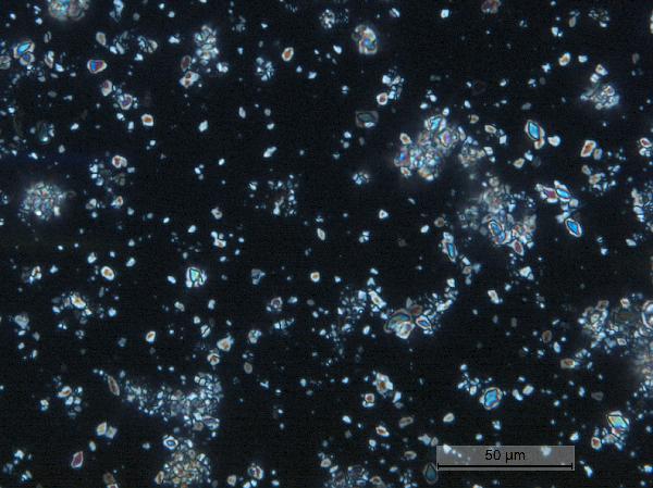 CARL-TWTW11-3D-5B-1-W_83cm_turbidite_40x_cp-600.jpg