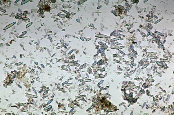Tritiform_aragonite_1ppl-600.jpg