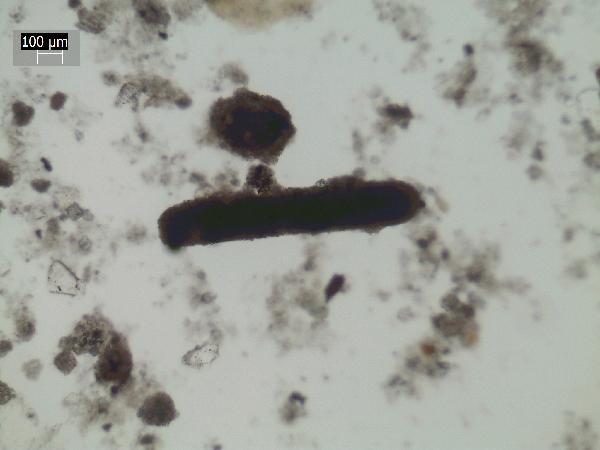 Brine_shrimp_fecal_pellet-600.jpg