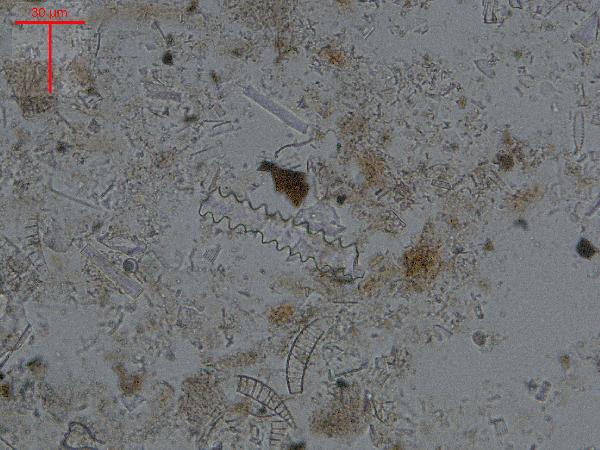 EYASI-phytolith4-600.jpg