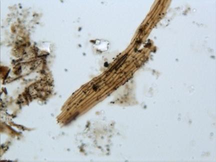 vascular-org-600.jpg